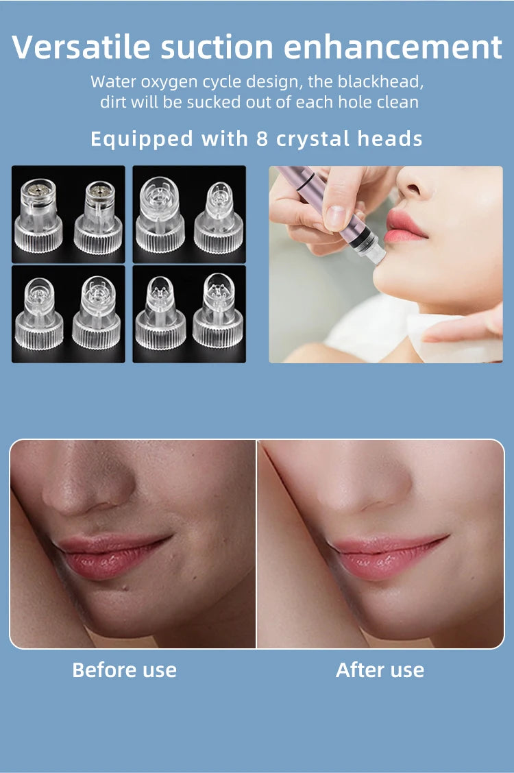 Beauty Small Bubble Blackhead Suction Instrument Hydrogen Water Oxygen Spray Vacuum Injection Clean Hydra Dermabrasion Device