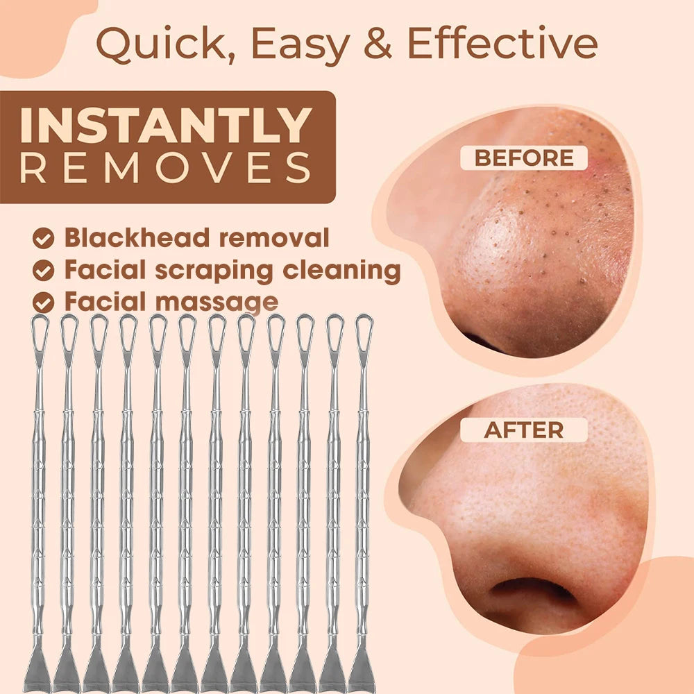Blackhead Remover Pimple Popper Tool Acne Needle Removing Treatment Comedone Whitehead Popping Zit Nose Face Blemish Extractor